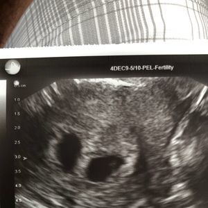 Meet your Posher, Babbie